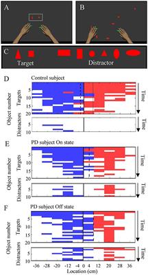 Assessment of Cognitive and Motor Skills in Parkinson's Disease by a Robotic Object Hitting Game